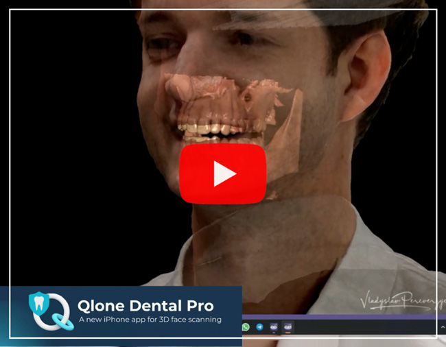 3Dスキャンでお顔全体をシミュレーション