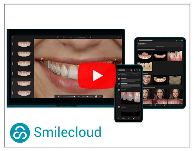 Smilecloudで理想の口元をデザイン